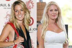 Heidi Montags enorma plastikförvandling