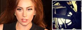 Lady Gaga opererad – visar upp rullstolen