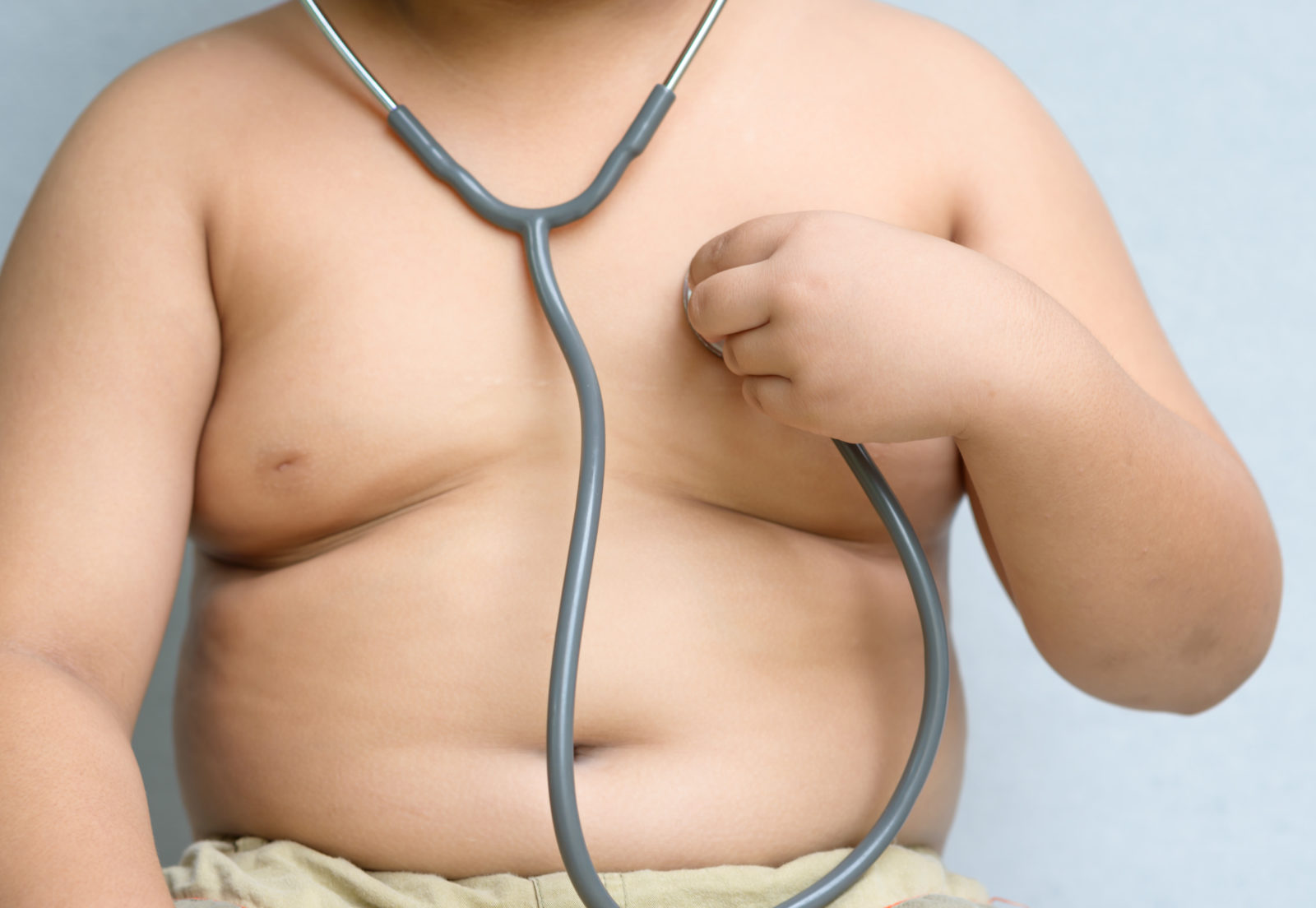 Har fetmarelaterade sjukdomar börjat förkorta den förväntade livslängden i USA?