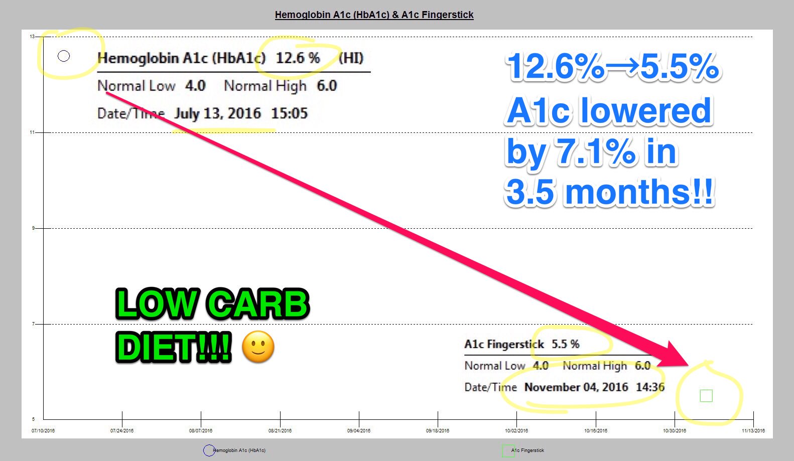 Typ 2-diabetes reverserad med endast LCHF