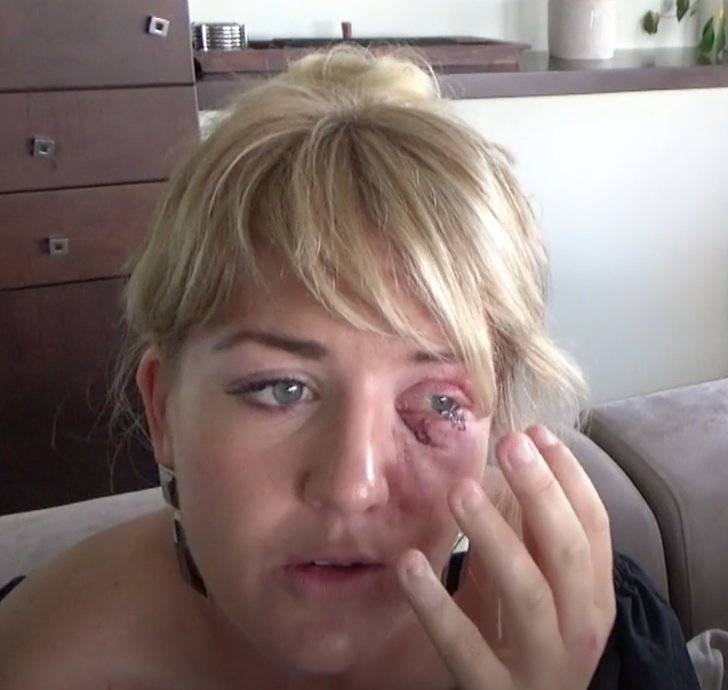 Här är Klara Svenssons läskiga krasch i Superstars
